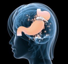 ✅PERDRE VOS KILOS EN TROP GRACE A LA POSE DE L' ANNEAU GASTRIQUE SOUS HYPNOSE POUR  MAIGRIR DURABLEMENT !!! OFFRE PROMO 50% DE REMISE SUR LA 1ER SEANCE