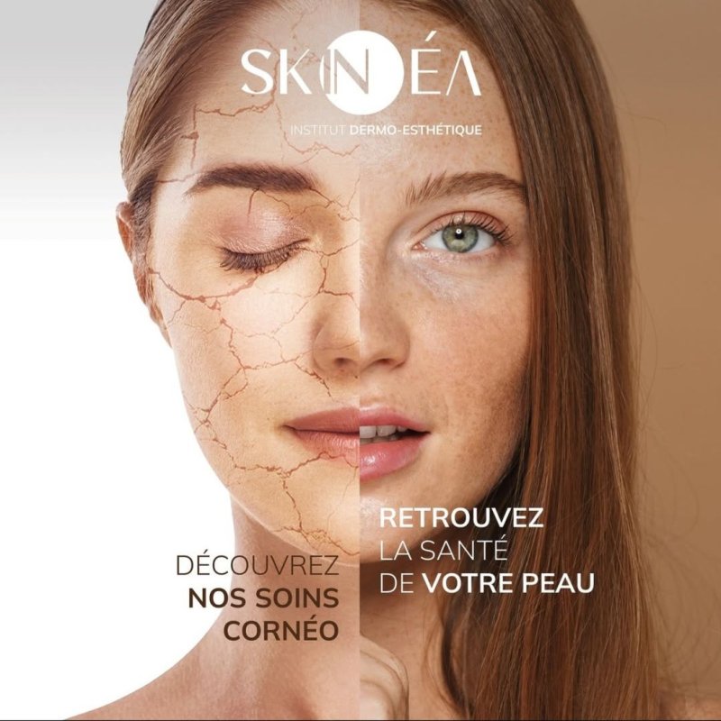 Semaine d'animation chez Skinéa! Des cadeaux et des remises pendant une semaine!