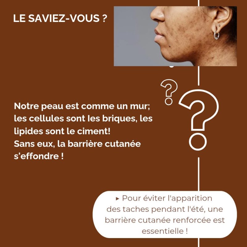 Comment éviter les taches pigmentaires?