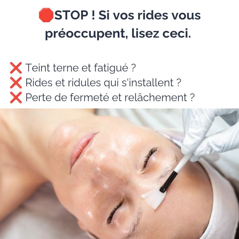STOP! Si vos rides vous pr&eacute;occupent, lisez ceci.